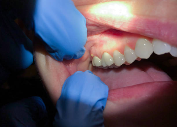 Best Emergency Denture Repair in Encantada Ranchito El Calaboz, TX